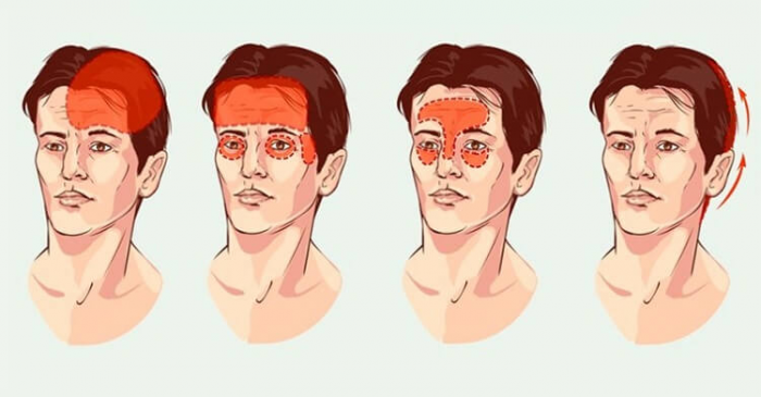ХИЖИНА ЗДОРОВЬЯ. Самый полный гид по головной боли ХИЖИНА ЗДОРОВЬЯ. Самый полный гид по головной боли