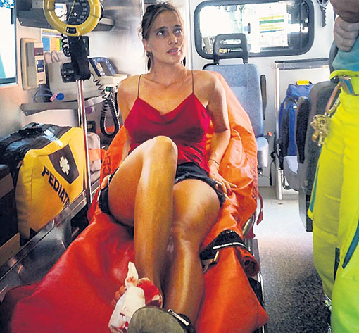 Певице Наталье ИОНОВОЙ (ГлюкоZе) страховка пригодилась в Италии, где она повредила ногу, упав с велосипеда