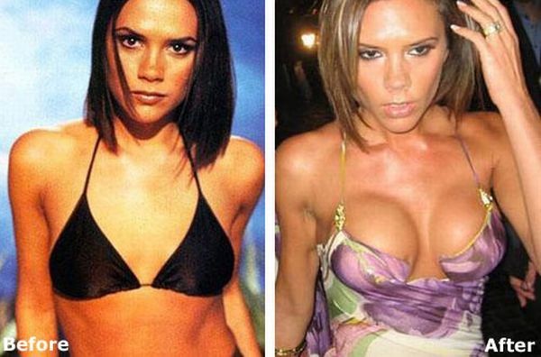 celebrities_before_and_after_boob_jobs_02