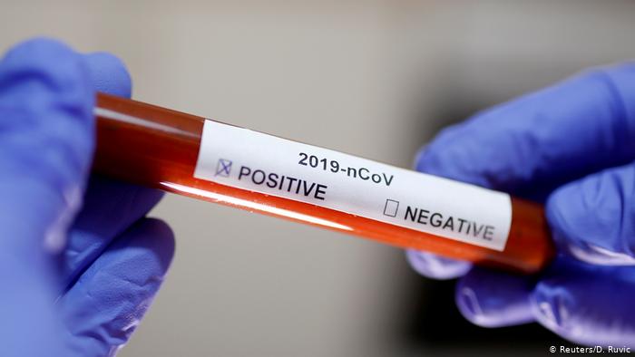 Какие шансы заразиться коронавирусом для людей с разными группами крови