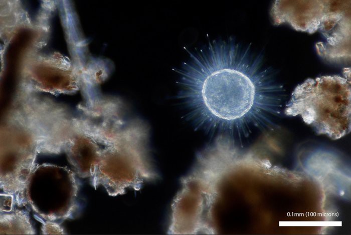 3. Одноклеточный центрохелидный солнечник, или Луна на небе чужой планеты Линден Гледхилл, микроскоп, фото