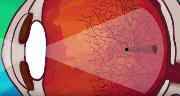 А вы наблюдали такую картину у себя перед глазами? (1) А вы наблюдали такую картину у себя перед глазами? (1)