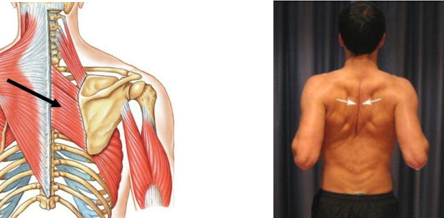 Главная мышца антисутулости: ромбовидная мышца