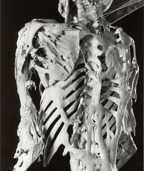 заболевания