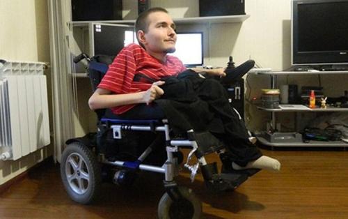 Пересадка головы Эта операция еще не состоялась, она должна пройти в 2017 году. Пациентом, кстати, будет наш соотечественник, программист Валерий Спиридонов. Он уже вылетел с США на первую консультацию и исследования.