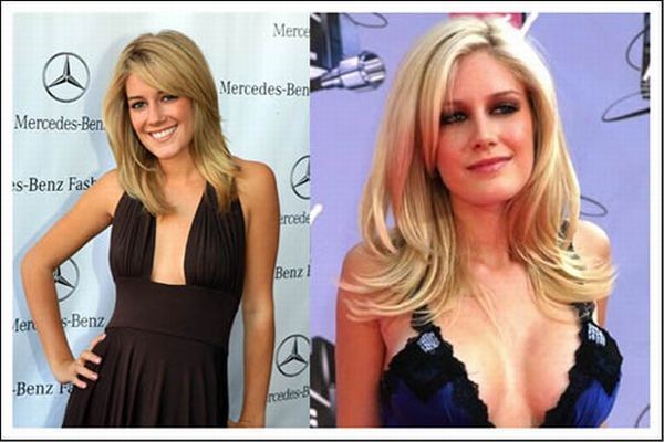 celebrities_before_and_after_boob_jobs_01