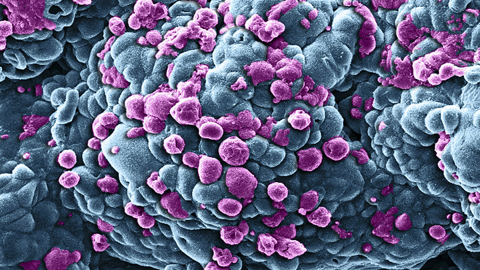Лучшие снимки из коллекции научных фотографий Wellcome