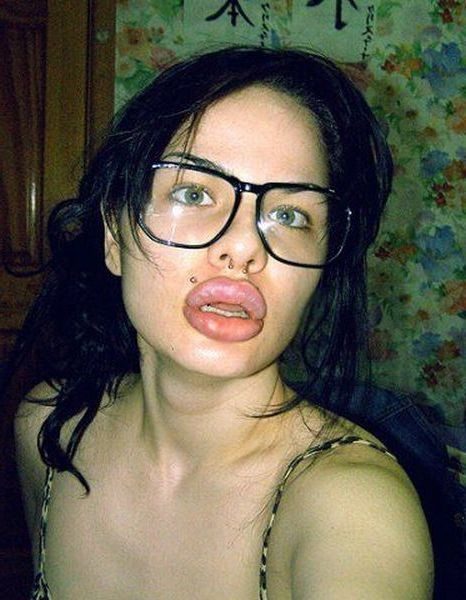 Губастики и их трудовые мазоли