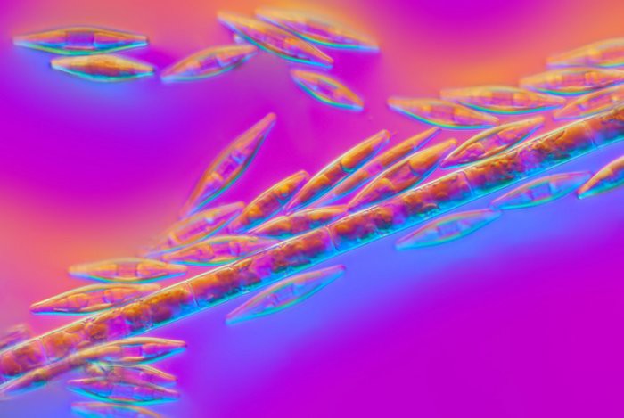 5. Дорожное движение диатомовых водорослей  Линден Гледхилл, микроскоп, фото