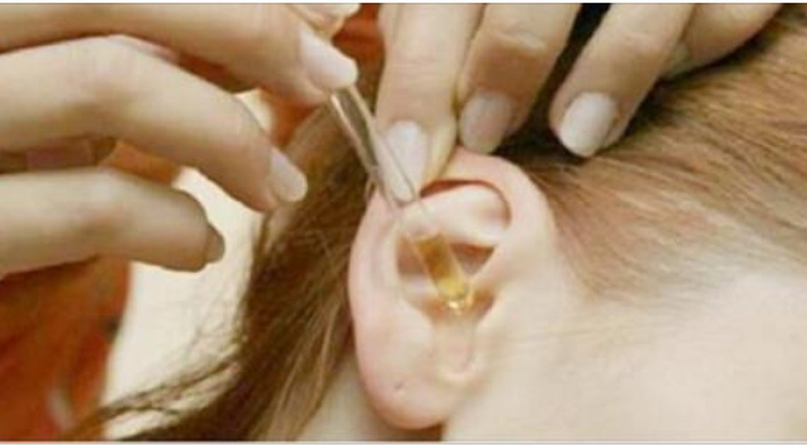 Самый простой и безопасный способ устранения серных пробок в ушах