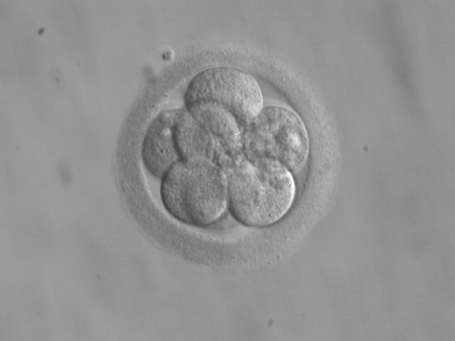 Редактирование генов на ранней стадии развития эмбриона может привести к неожиданным результатам в дальнейшем (фото Wikimedia Commons). 
