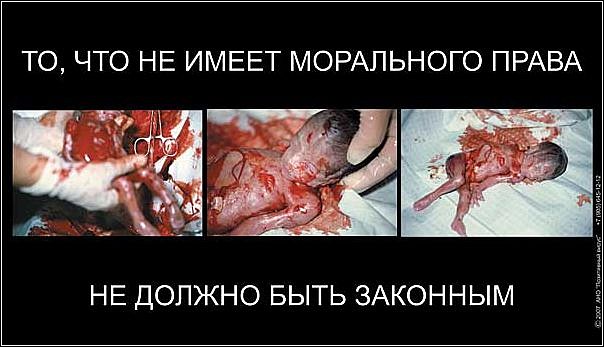 Ответы@Mail.Ru: Аборты