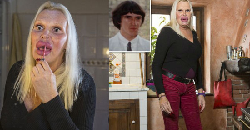     76 000       -    transgender,  , 