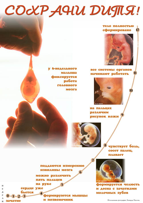 1. Эмбрион не тело матери, а человек [2. считается так в эмбриологии (МГУ)] 3. Честно об аборте. 7. КОГДА В ПЛОД ВСЕЛЯЕТСЯ ДУША
