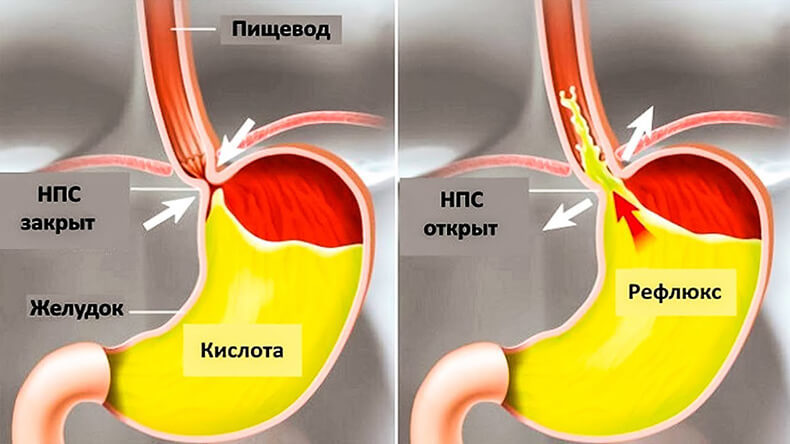 Как избавиться от лишнего веса и жира: Способ, который работает! Как избавиться от лишнего веса и жира: Способ, который работает!