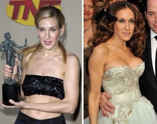 celebrities_before_and_after_boob_jobs_15