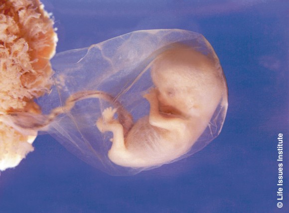 1. Эмбрион не тело матери, а человек [2. считается так в эмбриологии (МГУ)] 3. Честно об аборте. 7. КОГДА В ПЛОД ВСЕЛЯЕТСЯ ДУША