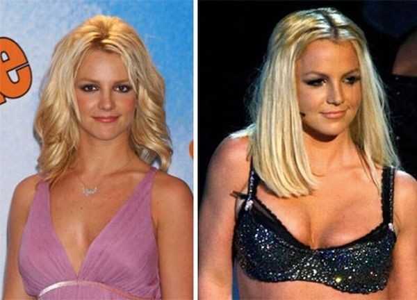 celebrities_before_and_after_boob_jobs_04