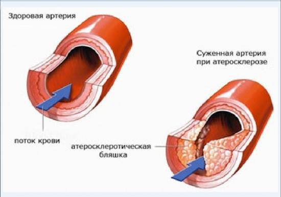 Наука. Преданы огласке сразу две крупнейших аферы