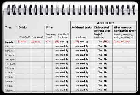 Дневник с записями по тренировке мочевого пузыря Дневник с записями по тренировке мочевого пузыря
