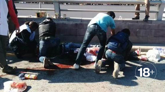 Число жертв теракта в Анкаре возросло до 30