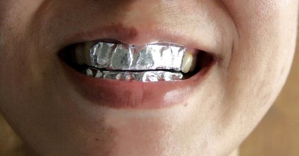 Она покрыла зубы пищевой фольгой с неожиданной целью… Результат впечатляет! Она покрыла зубы пищевой фольгой с неожиданной целью… Результат впечатляет!