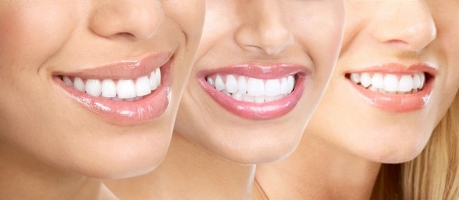 белоснежные зубы