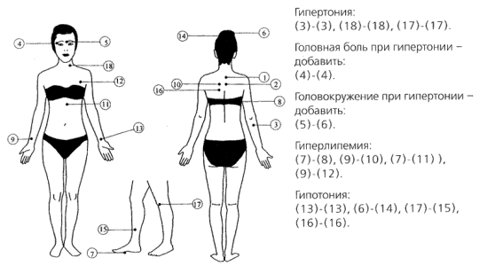 гипертония, головная боль при гипертонии, головокружение при гипертонии, гиперлипемия, гипотония.