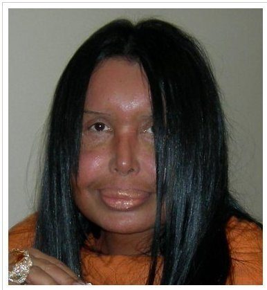 Губастики и их трудовые мазоли