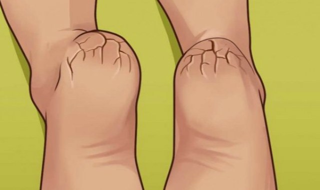 05-810x425-600x400