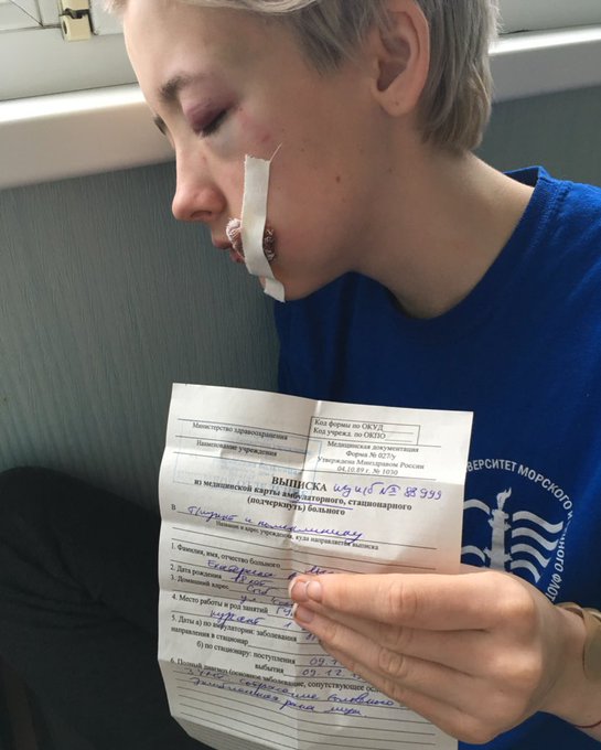 3 жестких факта о том, как в Питере 7 парней избили девушек за то, что они держались за руки