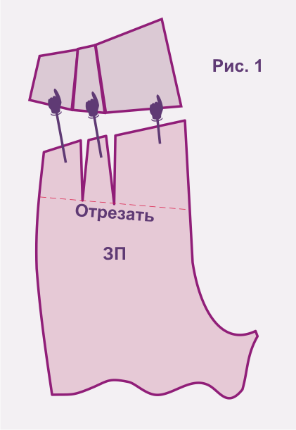 чешутся ноги после носков