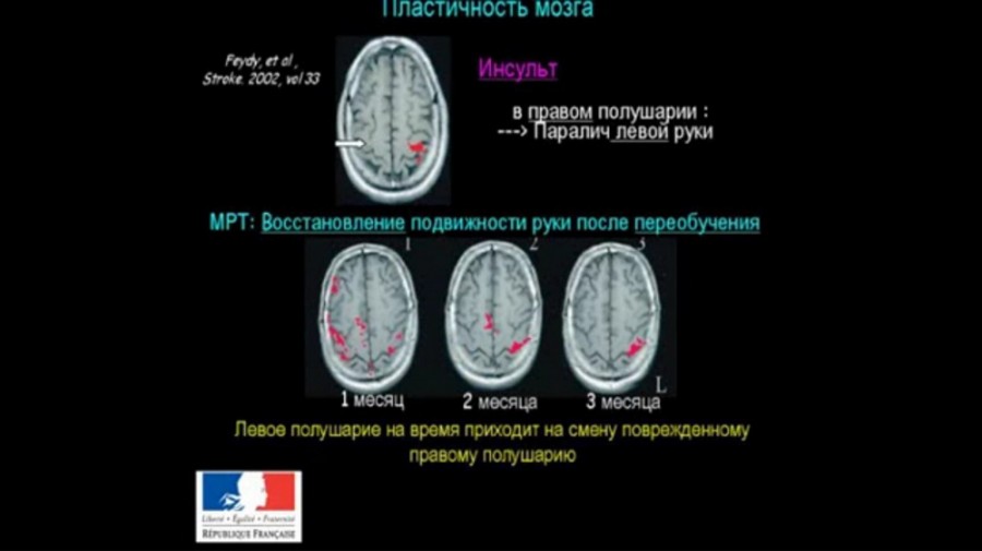 виндаль21-2 Как устроен мозг