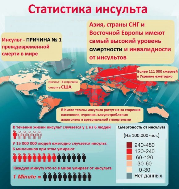 Инсульт головного мозга: факты, которые вы должны знать