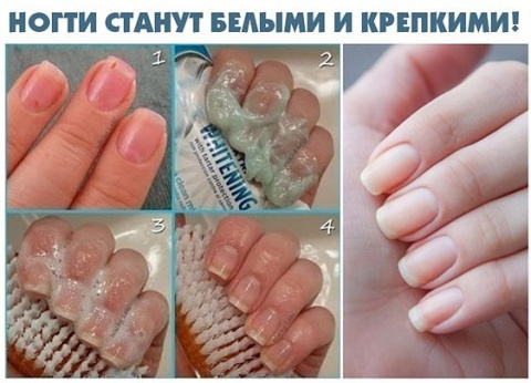 Чтобы ногти всегда выглядели ухоженными и были белыми, длинными и крепкими