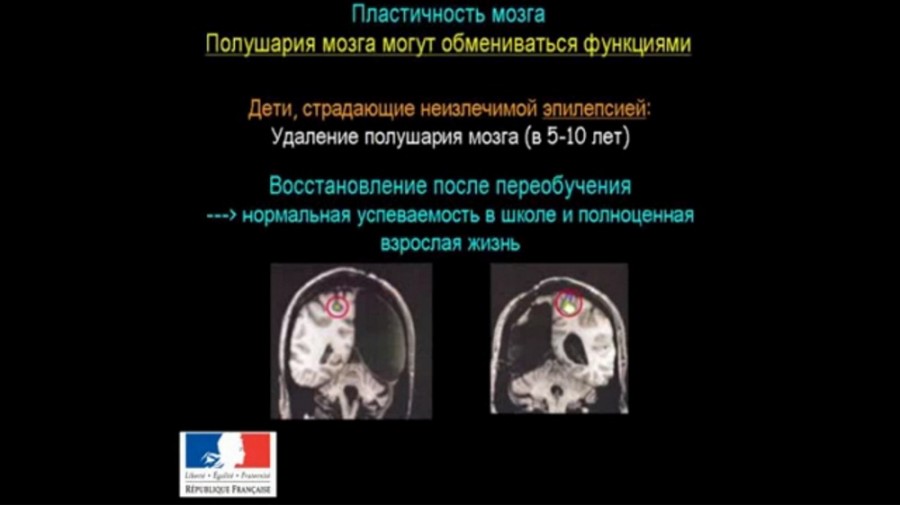 виндаль22-2 Как устроен мозг