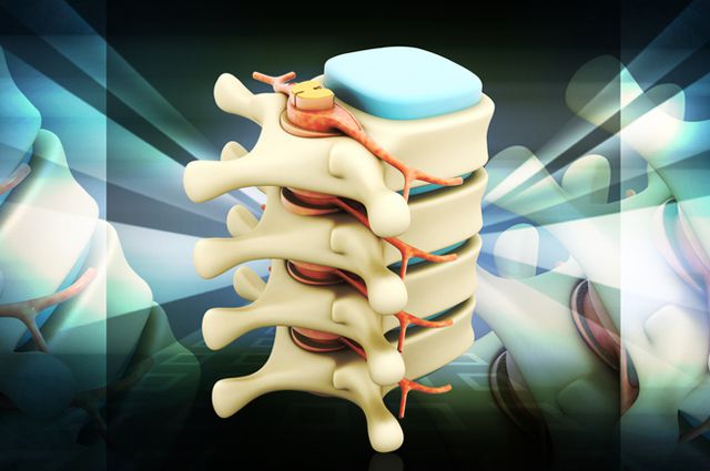 Что делать, если вы не можете стоять и сидеть из-за боли в спине? Что делать, если вы не можете стоять и сидеть из-за боли в спине?