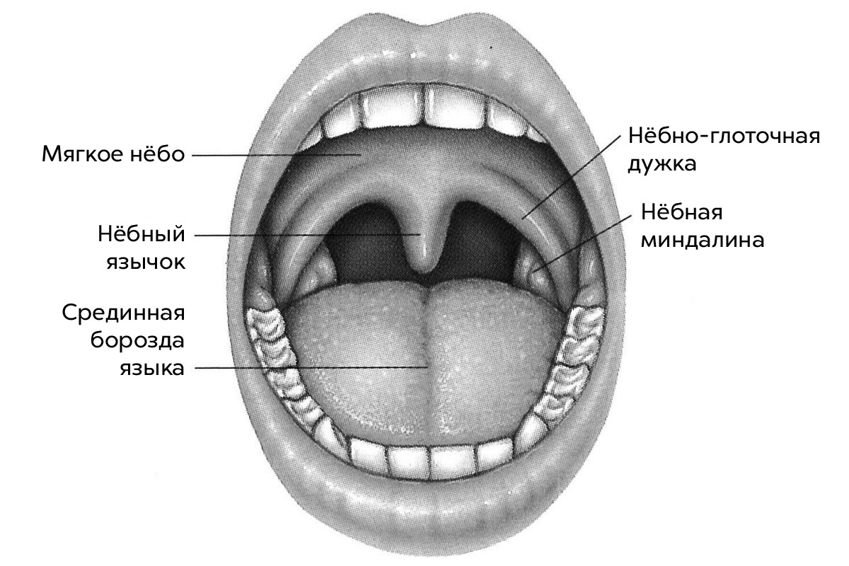 Зачем удалять миндалины?