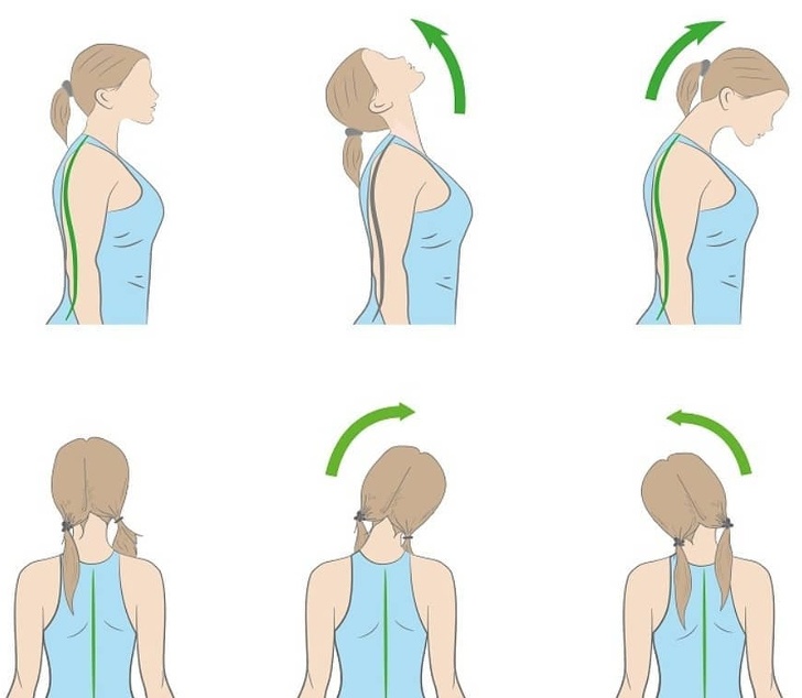 7 эффективных способов избавиться от боли в шее