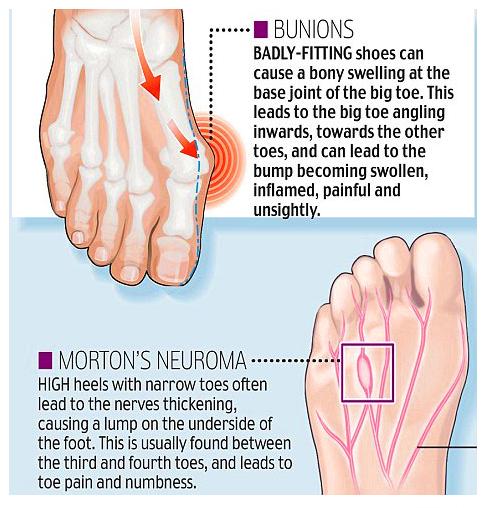 Женщины на каблуках Женщины на каблуках