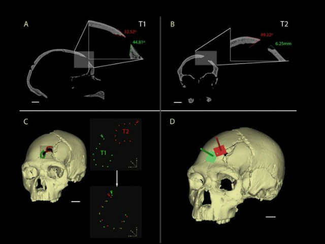 Визуальная реконструкция черепа позволила установить, что оба удара были сделаны одним и тем же предметом с примерно одинаковой силой (иллюстрация Nohemi Sala et al.).
