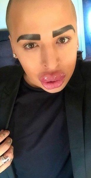 Губастики и их трудовые мазоли