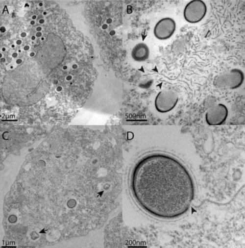 Вирус Mollivirus sibericum #2 Вирус Mollivirus sibericum #2