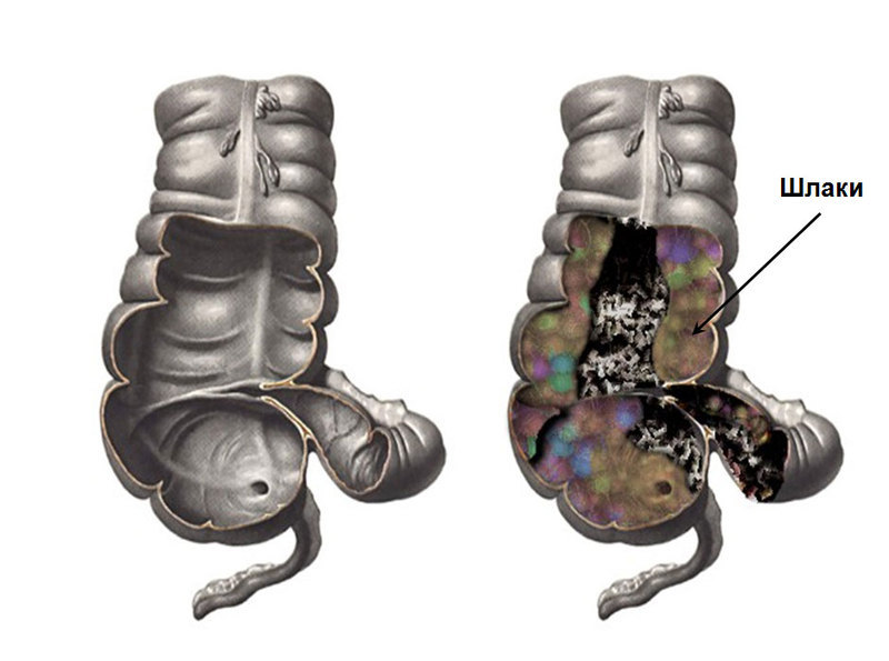 Марва Оганян: Смерть идет из кишечника