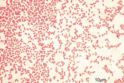 Грамотрицательные бактерии Pseudomonas aeruginosa
