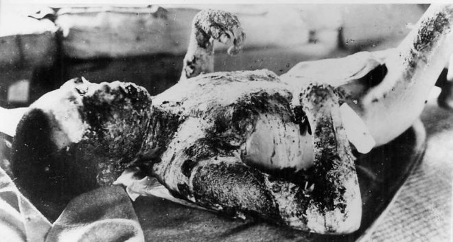 65 лет ядерной бомбардировке Хиросимы и Нагасаки. Взгляд через время