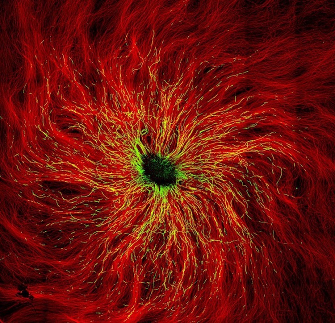 Лучшие микроскопические снимки, на которых можно разглядеть рот пузырчатки и нейроны мыши