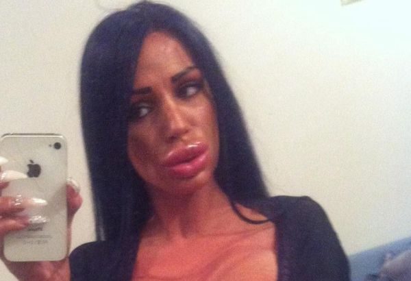 Губастики и их трудовые мазоли