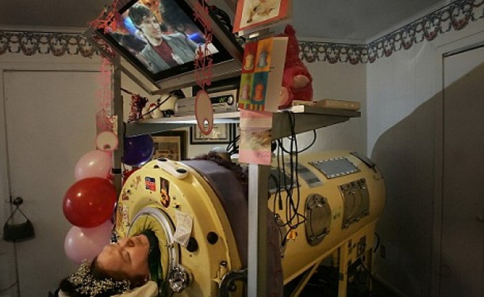 Железная леди: Как и почему Диана Оделл 60 лет прожила в «танке» для вентиляции легких