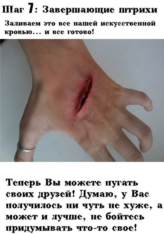 Порез на руке в домашних условиях Порез на руке в домашних условиях